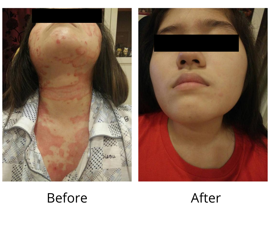 SOL Integrative Skin Disease Treatment Centre